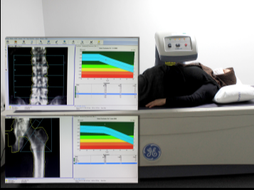 Hastanemiz Kemik Dansitometri Ünitesi Yeni Yerine Taşındı